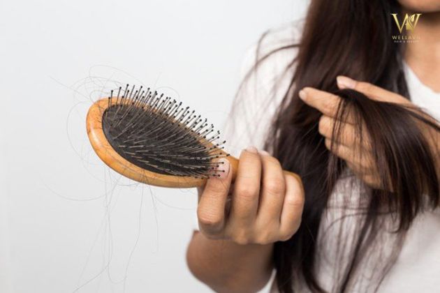 Cách giải mã mộng thấy rụng tóc