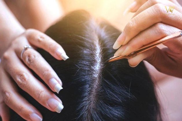 Cách chữa trị tóc không mọc lại sau khi nhổ