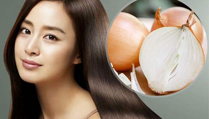 Gợi ý 10+ Cách trị rụng tóc tại nhà hiệu quả nhất chỉ sau 2 tuần Cách chữa rụng tóc ở đỉnh đầu bằng Hành Tây