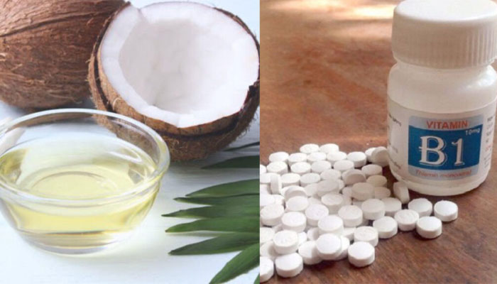 5 cách gội đầu với dầu dừa trị gàu, ngăn rụng tóc hiệu quả Cách gội đầu bằng b1 và dầu dừa