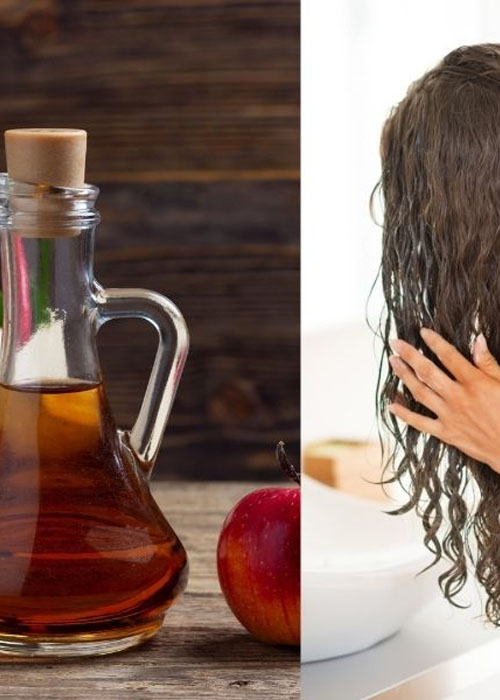 Top 5 Cách gội đầu sạch gầu tại nhà ngăn ngừa tái phát Cách gội đầu trị gàu bằng giấm táo