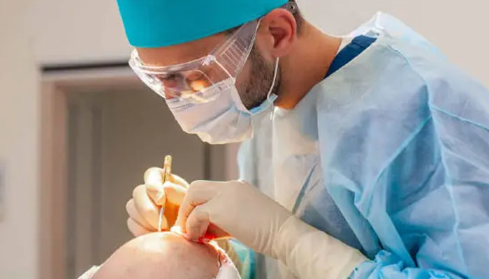 Gợi ý 10+ Cách trị rụng tóc tại nhà hiệu quả nhất chỉ sau 2 tuần Chữa rụng tóc bằng cách phẫu thuật cấy tóc