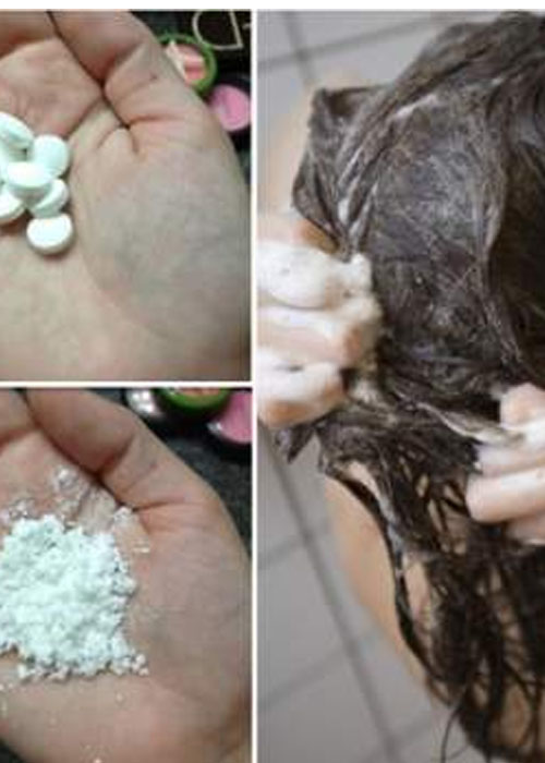 Top 5 Cách gội đầu sạch gầu tại nhà ngăn ngừa tái phát Mẹo gội đầu sạch gầu bằng aspirin