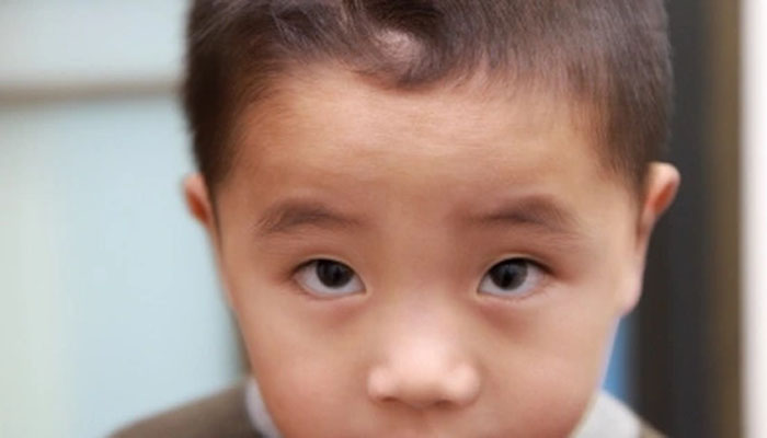 Tóc có xoáy trước trán