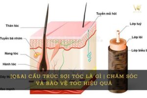 cau truc soi toc 4 1