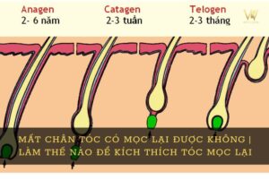 Nang tóc bị teo có phục hồi lại được không