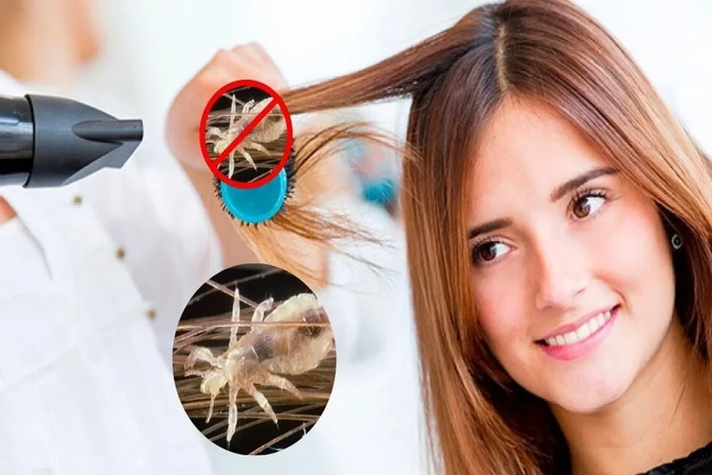 Cách diệt chấy bằng máy sấy tóc #Hiệu quả ngay tại nhà Có nên dùng máy sấy tóc để diệt chấy