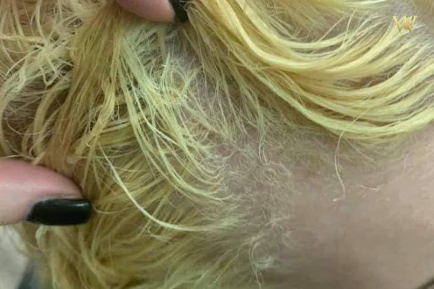 tẩy tóc có hại không