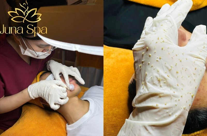 Vì sao mỗi làn da cần một liệu trình riêng