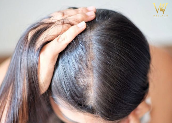 Tóc ít nên cắt kiểu gì để luôn bồng bềnh trẻ xinh Tóc ít nên cắt kiểu gì